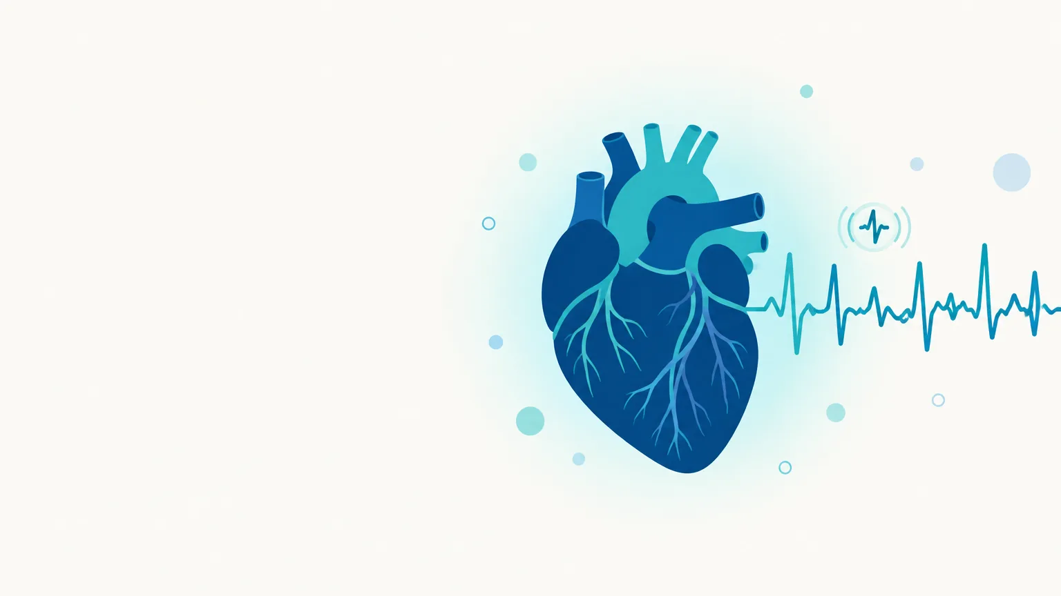 Ilustração Fibrilação Atrial
